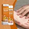 Spray Nutritivo para Uñas Ximonth Cuidado Suave, Limpieza, Cuidado de Manos y Pies, Fortalecimiento de la Superficie de las Uñas, Hidratación y Suavizado de Cutículas