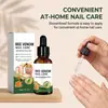Líquido para Cuidado de Uñas con Veneno de Abeja - Hidratante, Suavizante, Suave, Brillante, Refrescante, Cómodo Líquido para Cuidado de Uñas de Manos y Pies