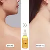 Óleo Essencial de Cúrcuma e Mel Transfronteiriço 30ml Óleo de Cúrcuma e Mel