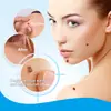 Crema Sumifun para eliminación de verrugas transfronteriza, crema alisadora para callos y verrugas, crema facial para eliminación de verrugas y callos