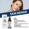 Gotas XIMONTH para Cuidado do Ouvido Cuidado Diário Suave Refrescante Massagem Confortável Gotas Portáteis