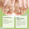 Juego para el Cuidado de Uñas de Manos y Pies Cuidado de Uñas de Pies Onicomicosis Uña Brillante Uña Suave Solución para el Cuidado de Uñas Encarnadas