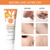 Lakerain Gel Exfoliante Transfronterizo Qu Gel Limpiador Facial Limpiador de Poros Gel Limpiador Suave Hidratante