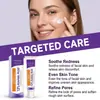 Crema Facial con Ácido Salicílico Cuidado Suave Piel Propensa al Acné Cómoda Piel Lisa y Clara Crema Hidratante para el Rostro