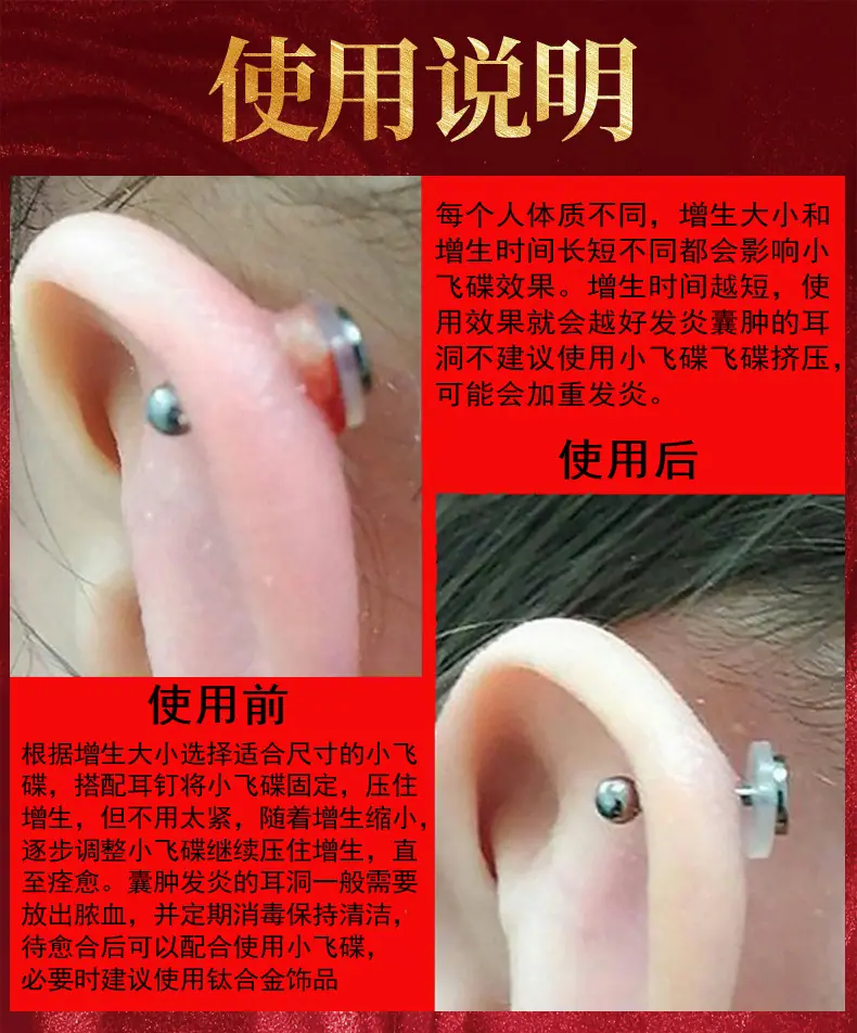 详情3