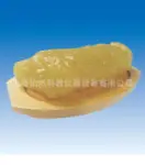 脂肪模块 模病理模型