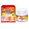 Ungüento de Diagnóstico Húmedo Inglés Personalizado de Fábrica para Erupción Cutánea, Enrojecimiento, Hinchazón, Molestia, Picazón en la Piel, Cuidado Externo y Ungüento para el Cuidado de la Salud