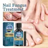 Ximonth Solución Reparadora de Uñas Uña Encarnada Engrosamiento Iluminación Uña Onicomicosis Uña Blanda Solución para el Cuidado de Uñas de Manos y Pies