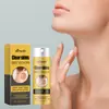 Spray de Cuidados com a Pele de Veneno de Abelha Ximonth Spray de Limpeza Corporal Suave para Suavizar e Amaciar a Pele