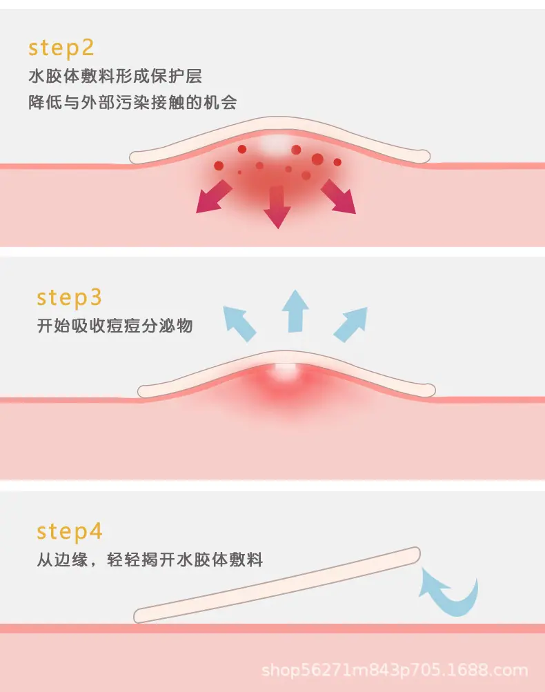 黄色款_05.jpg