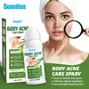 Sumifun Nuevo Producto Transfronterizo Spray para el Cuidado del Dolor de Juanetes de Jengibre Alivio del Dolor Articular Líquido Penetrante para el Cuidado de la Salud en Spray