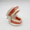 Modelo de Dente Dentário, Modelo de Cárie Dentária, Prática de Preparo Oral, Modelo de Dente Falso, Ferramenta de Ensino de Modelo de Dente Não Removível