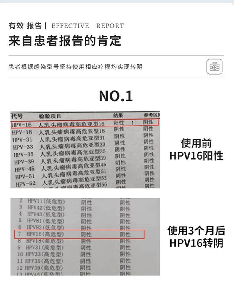 珺普惠医用抗HPV生物蛋白功能敷料病毒干扰素凝胶降低载量妇科阴