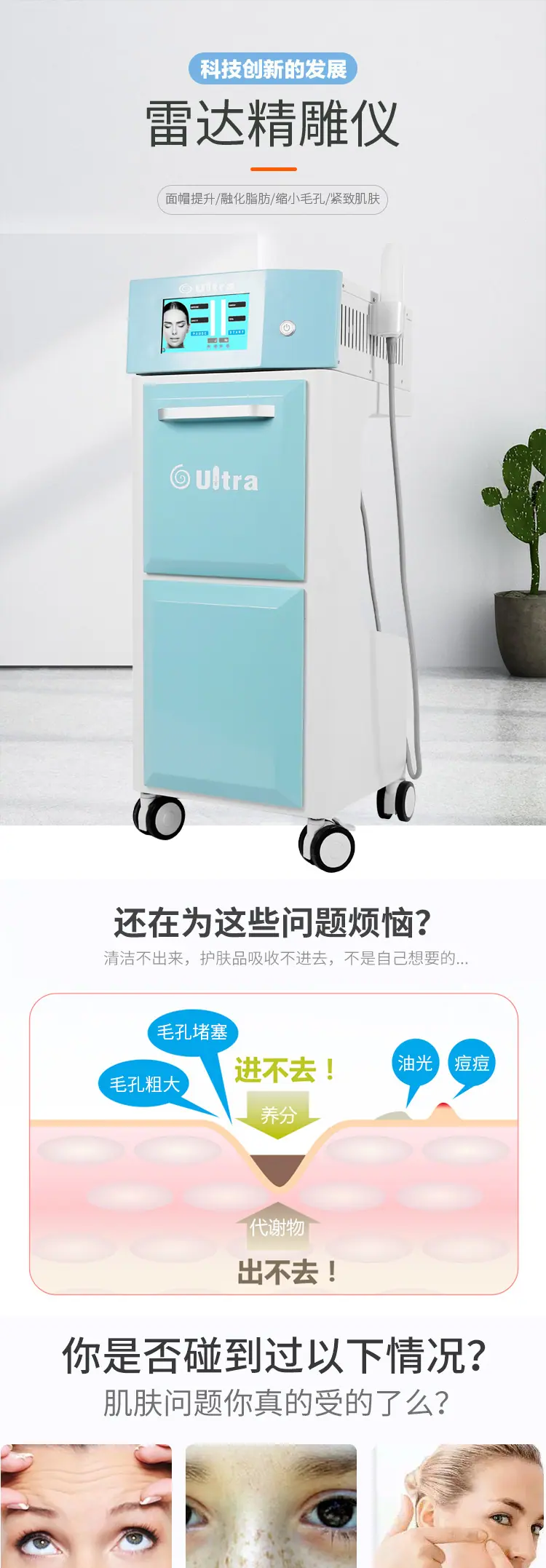 雷达精雕_01