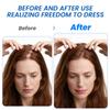 Kit de Cuidado para Alopecia Areata Transfronterizo Sumifun Yeso de Comercio Exterior al por Mayor Crema Nutricional para la Salud del Cuero Cabelludo Spray Externo