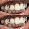 Europa e Estados Unidos venda quente nova presas simétricas zircônia barra de aparelho combinação personalidade dentaduras masculinas transfronteiriças acessórios hip-hop