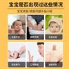 Fabricante parche para el cuidado de la digestión y el bazo Yuyi parche para la acumulación de alimentos parche para la acumulación de alimentos en niños parche para la flatulencia infantil anorexia parche de acupuntura