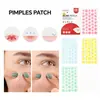 Parche para Acné Life Girl Star Amigable con la Piel Transpirable Limpieza Piel con Acné Eliminación Suave de Acné Herramienta de Belleza Transfronteriza