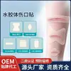 Apósito hidrocoloide médico para heridas, piel artificial impermeable, para la curación húmeda de heridas, tratamiento de quemaduras, extirpación de lunares y tratamiento del acné; apósito hidrocoloide