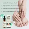 Solución para el cuidado de las uñas Suchodam Cuidado Diario Hidrata las Uñas, las Hace Cómodas y Brillantes, y Limpia Suavemente la Superficie de la Uña