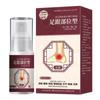 Gel de compresa fría para talón Tiktok, vaina del tendón cervical, eliminación del espolón del talón, aceite esencial en aerosol, se puede usar para la regeneración del cabello.