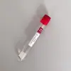 Suministrado Directamente por el Fabricante, Tubos Desechables para Recolección de Sangre Prp con Vacío Acdgelbiotin Tratamiento para la Caída del Cabello Tubo de Recolección de Sangre Prp de Vidrio