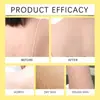 Jabón OCEAURA Personalizable de Limón, Cúrcuma y Ácido Kójico, Jabón de Baño Limpiador e Hidratante Corporal, Más Vendido en Ventas Transfronterizas