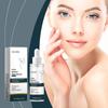 Esencia Facial de Retinol OUHOE Mantenimiento Suave Elasticidad de la Piel Aclaradora Solución Hidratante