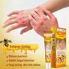 Sol Lora Superventas Transfronterizo de Amazon Veneno de Abeja Alivia la Picazón de la Piel Eczema de Manos por Veneno de Abeja (Caja amarilla) Sol057