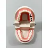 Modelo Dental Cepillado Oral Dentadura Postiza Boca Completa Dental Removible Encía Suave Transparente Implante Resina Preparación Dental Molde Dental