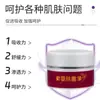 Lithospermum Limpieza de Picaduras de Piel Oem Oem Crema Antibacteriana Piel de Vaca Picazón de Piel Pomada Anti-Picazón Personalización de Puesto