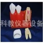 四倍牙分解模型医学模型