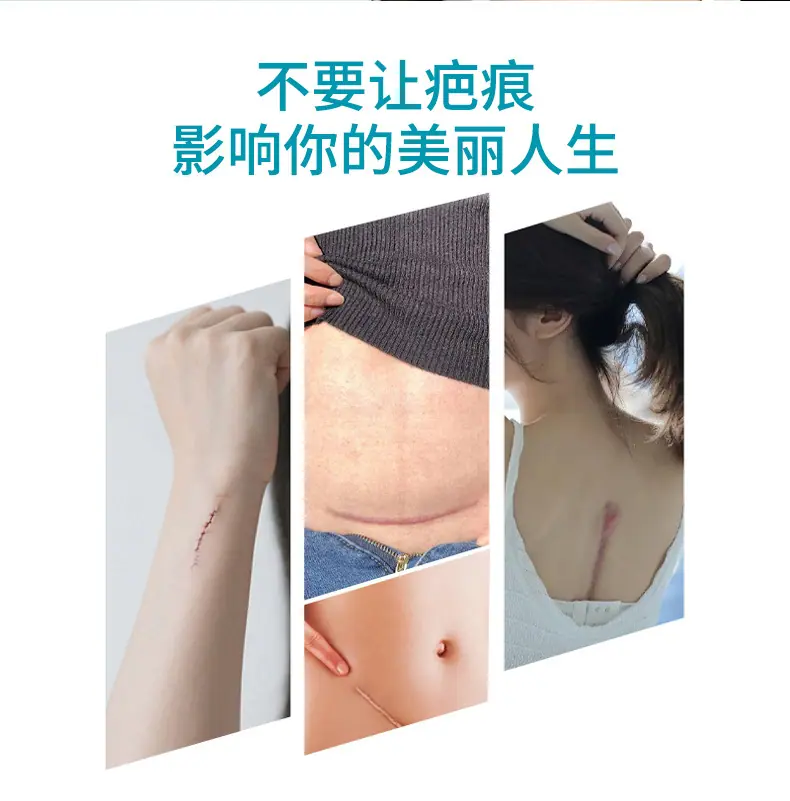 医用硅酮疤痕凝胶详情8