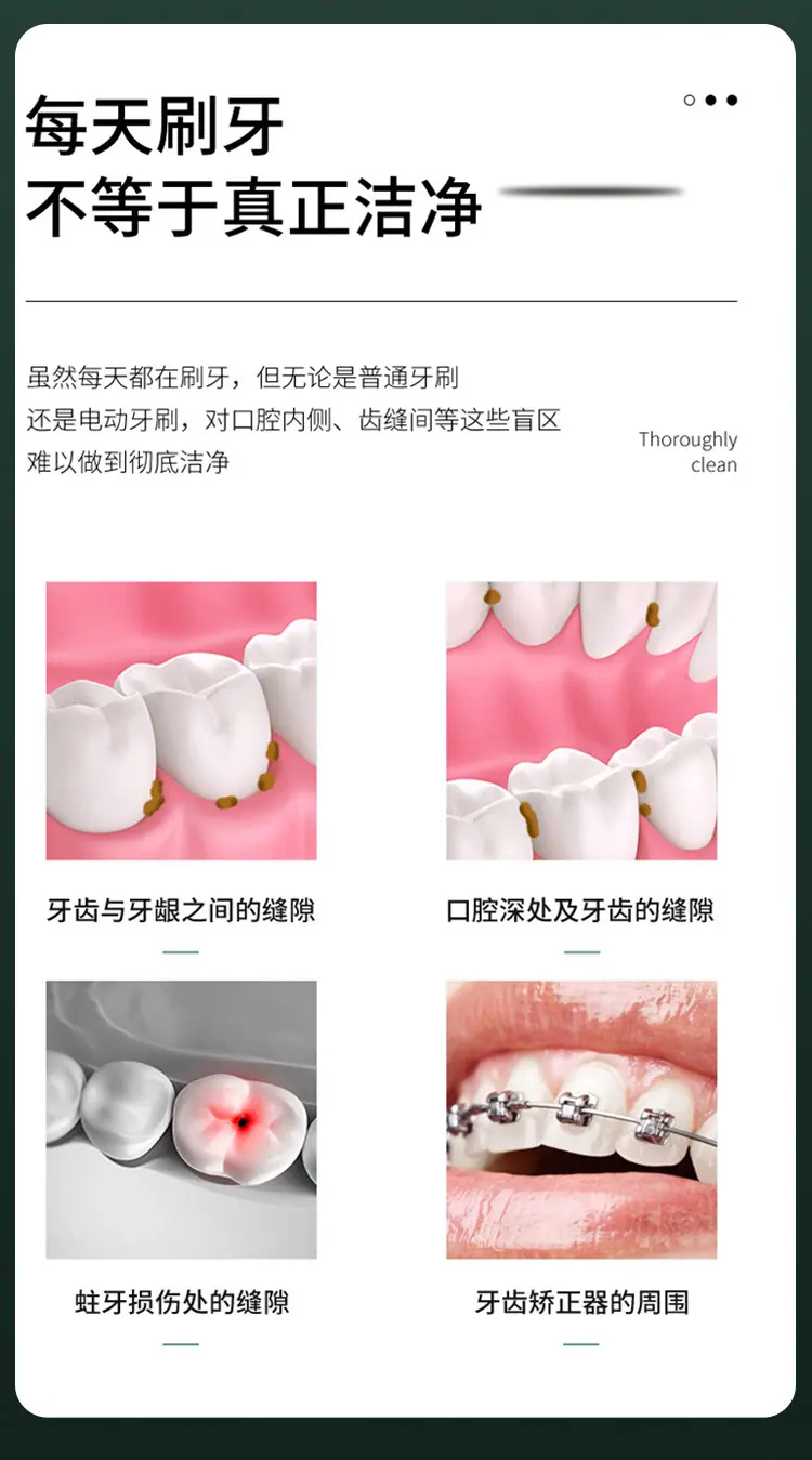 冲牙器2_03