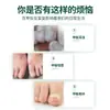 Solução de Limpeza de Unhas em Estoque para Venda por Atacado para Remover Fungos nas Unhas, Solução Suavizante Especial para Cuidados com as Unhas, Solução Herbal para Fungos nas Unhas dos Pés