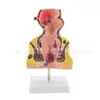 Modelo de lesión de hemorroides patología anorrectal modelo de hemorroides modelo de fisura anal interna y externa modelo médico de hemorroides