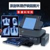 Filme médico azul para jato de tinta Filme de radiologia para impressão com base azul Filme de Raio-X para fratura dentária DR CR CT
