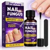 Solución para el cuidado de la onicomicosis de uso externo transfronterizo Esencia de planta para hongos en las uñas Tratamiento para el color uniforme de las uñas