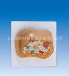 病理乳房模型病理模型