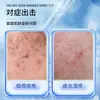Nanjing Tongrentang Fuente Mecánica Tamaño de Fuente Salud Médico Jin Jiqing Cuidado de la Piel Médico Ungüento Multifuncional (Adulto) Fabricante