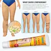 Sumifun Crema Medicinal Transfronteriza de Amazon Crema Reparadora Linfática Crema de Masaje para Piernas Ungüento Herbal Calmante K10163