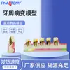 Fornecimento de Modelo de Dente com Doença Periodontal para Adultos Pnt-Or13 Resina Enfeites de Ensino Odontológico Oral