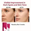 Crema Facial Sauvasine 7% Arbutina + 4% Ácido Tranexámico Transfronteriza 50ml