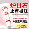 Pomada Antibacteriana de Calamina Atacado Bebê Anti-Coceira Calmante Refrescante Ervas Pomada Antibacteriana de Calamina para Picadas na Pele