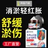 Crema para Hematomas Palacio Chuanhong Alivia el Dolor y Elimina Manchas Moradas para Adultos y Niños, Elimina Rápidamente los Moretones y Elimina la Congestión de Suero Sanguíneo