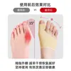 Corrector de Dedos del Pie, Dispositivo de Corrección de Juanetes, Separador de Dedos para Hombres y Mujeres, Adecuado para Huesos Salientes del Dedo Gordo del Pie, Se Puede Usar con Zapatos