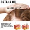 Serie Completa de Cuidado del Cabello con Aceite de Batana Jaysuing Transfronterizo Combo Fortalecedor de Raíces para Reparación y Cuidado del Cabello Seco