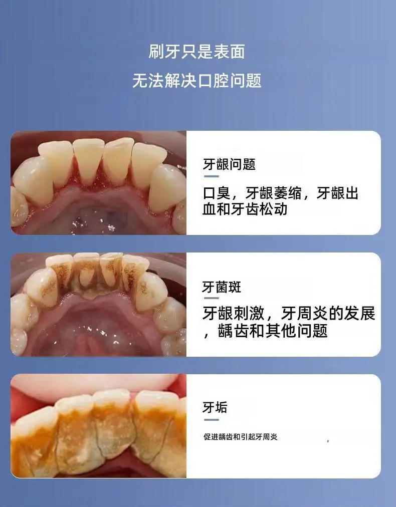 洁牙器-详情_05