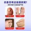 Solución de Cuidado de Uñas de los Pies de una Sola Pieza del Fabricante, Solución Especial para el Cuidado de los Pies, Solución para Onicomicosis Tipo Gotero, Solución para el Cuidado de Uñas y Pies, En Stock
