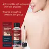 Essência Laniska para Cuidados com a Pele Ingredientes Suaves Cuidado Pele do Corpo Hidratação Hidratante Essência Xadrez